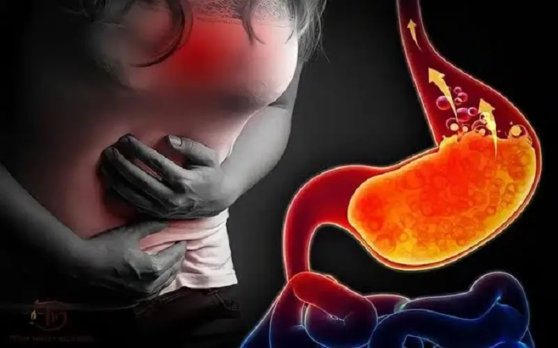 Dấu hiệu trào ngược dạ dày ở cổ họng và đường hô hấp